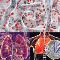 Course 175 Healthcare: Biological Hazards Overview Page